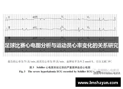 足球比赛心电图分析与运动员心率变化的关系研究